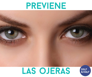 6 alimentos que previenen las ojeras